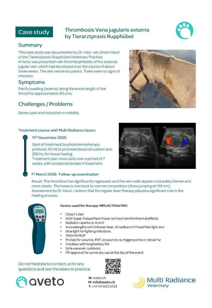 Laser Therapy thrombosis vena jugularis externa 